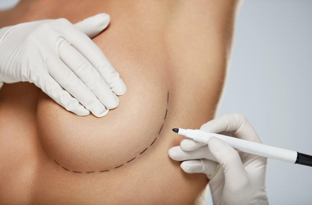Implanty piersiowe – jak dobrać idealny kształt i rozmiar?