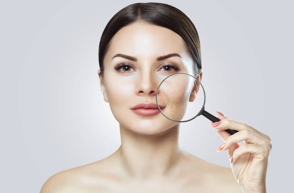 Resurfacing skóry – szybki sposób na poprawę wyglądu i pewności siebie