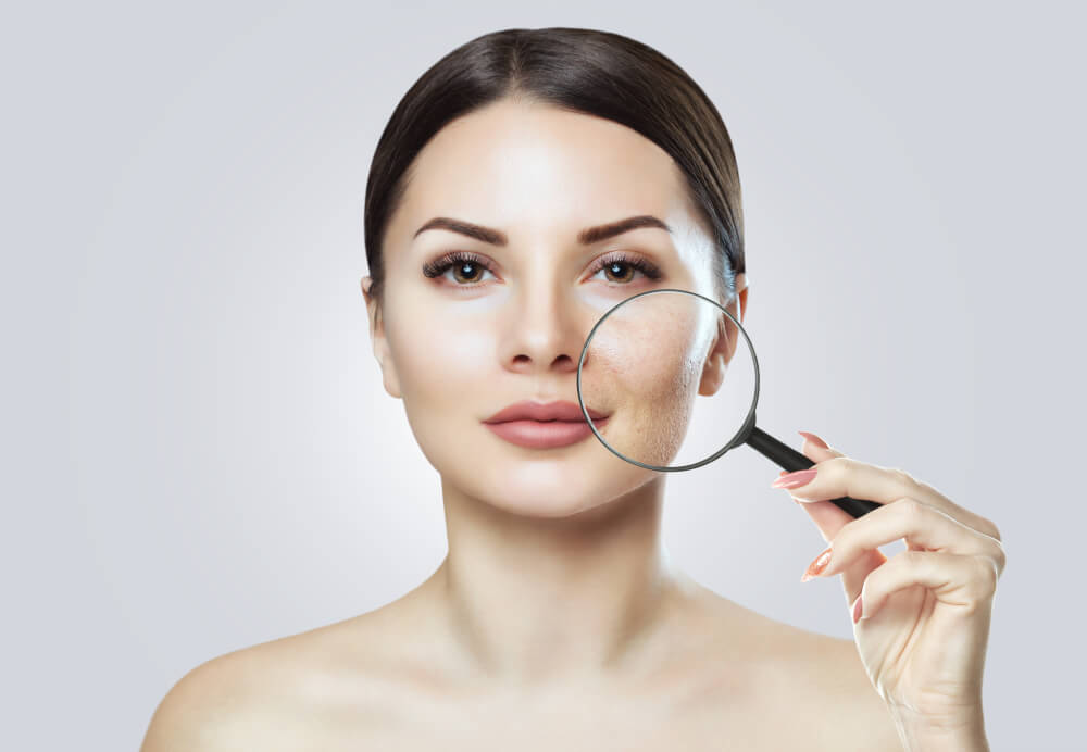 Resurfacing skóry – szybki sposób na poprawę wyglądu i pewności siebie