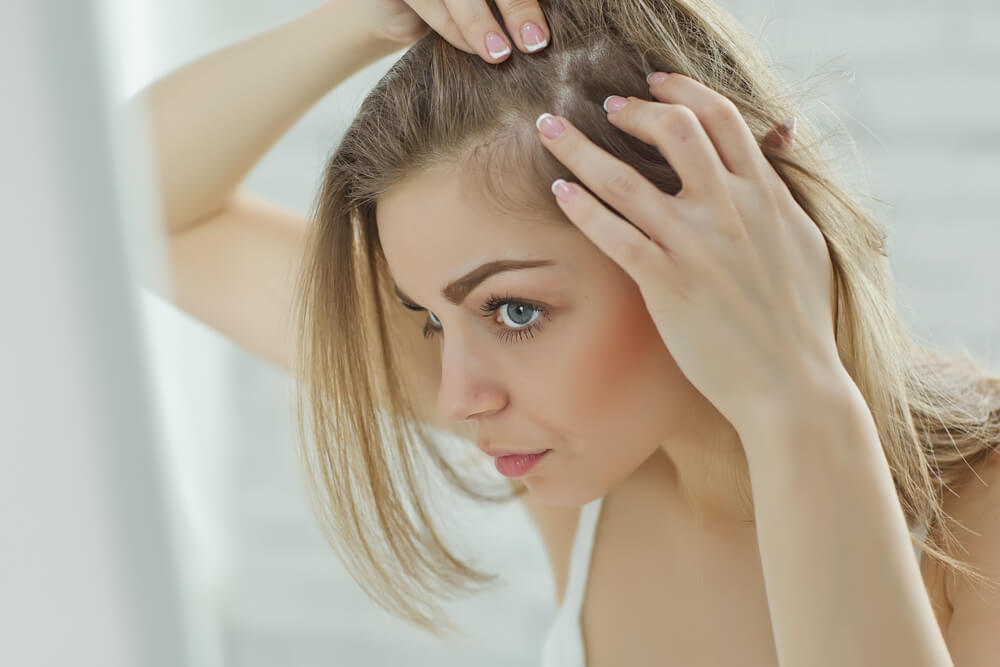 Czy łysienie androgenowe można zatrzymać?