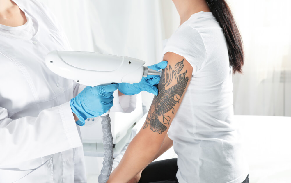Usuwanie tatuażu w gabinecie medycyny estetycznej – czy jest skuteczne?
